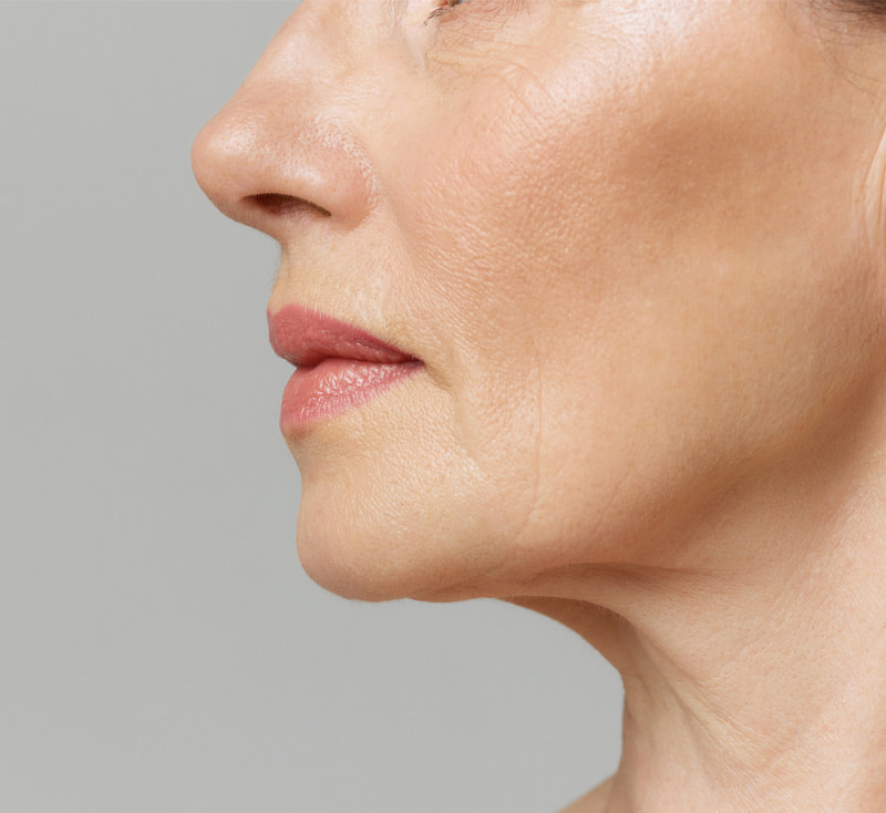 Lip Fillers vs. Lip Flip vs. Lip Lift | Finding Your Perfect Lip Enhancement