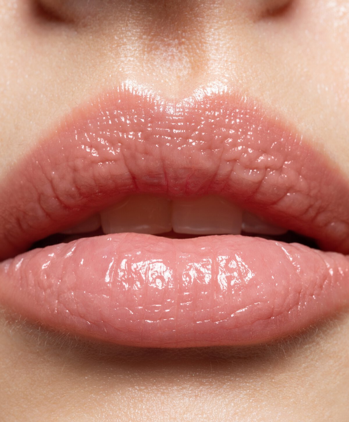 close up of Brooklyn lip lift model